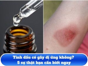 Tinh dầu có gây dị ứng không? 5 sự thật bạn cần biết ngay